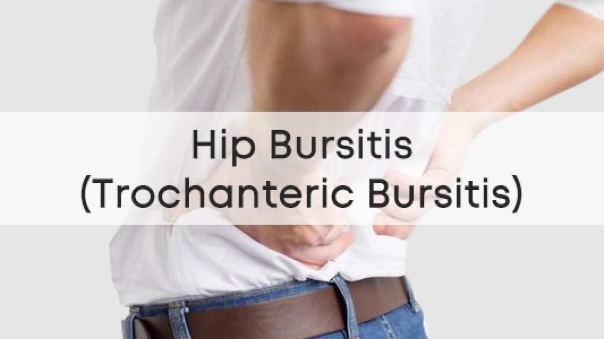 Hip/Trochanteric Bursitis? (Watch This!) 