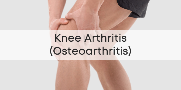 Knee Arthritis (Osteoarthritis)