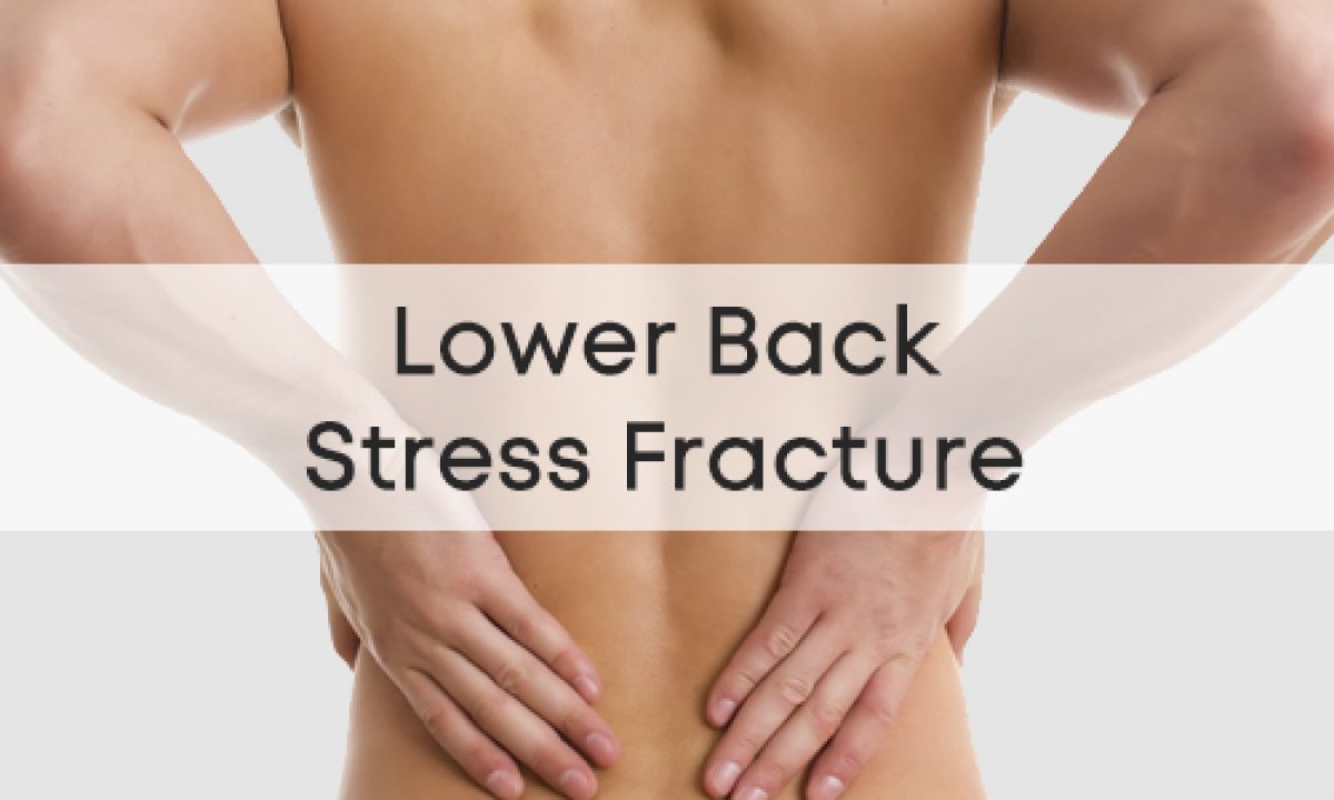 Lower Back Stress Fracture Treatment Doctorvisit