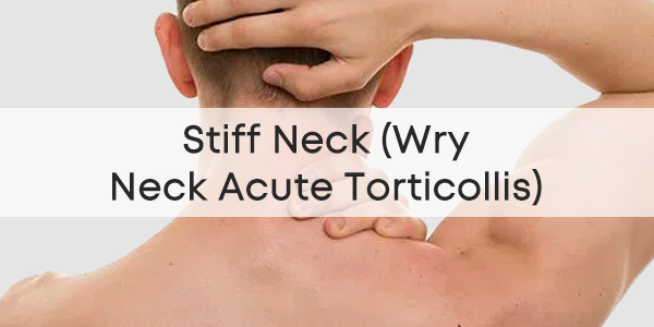 wry-neck-acute-torticollis-physioroom-advice