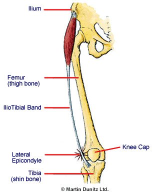 Iliotibial Band Friction Syndrome | PhysioRoom