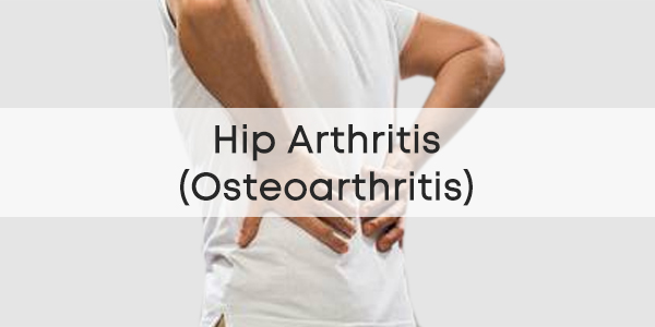 Hip-Arthritis