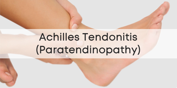 Achilles Tendonitis (Paratendinopathy)