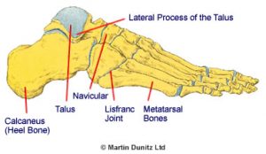 Snowboarder's Ankle Treatmen | PhysioRoom Advice