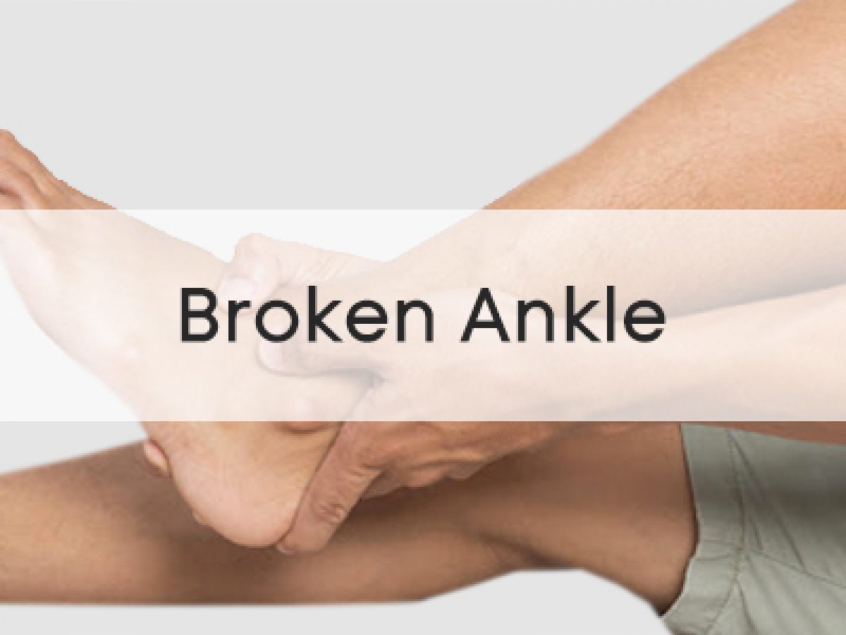 Broken Ankle  PhysioRoom Advice