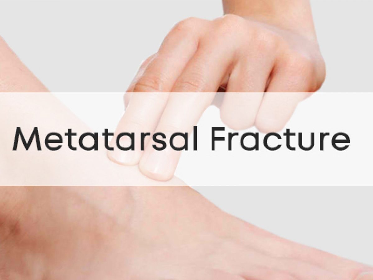 Metatarsal Fracture Broken Foot | PhysioRoom Injury Advice