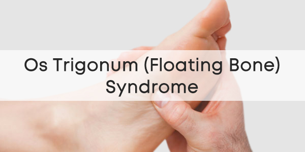 Os-Trigonum-Floating-Bone-Syndrome