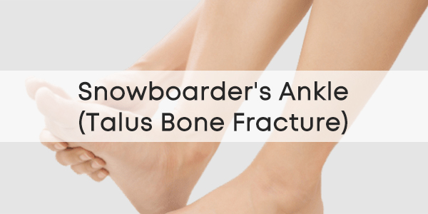 Snowboarders-Ankle-Talus-Bone-Fracture