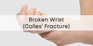 Broken Wrist (Colles Fracture) | PhysioRoom Guide